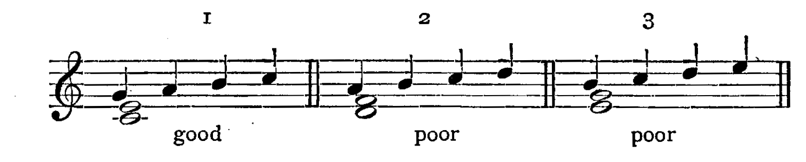Figure 155